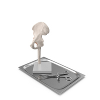 Anatomical Model of Hip Joint with Bone Holder Ollier PNG & PSD Images