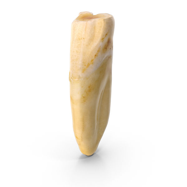 Broken Incisor Upper Jaw Central PNG & PSD Images Broken Incisor Upper Jaw Central PNG & PSD Images