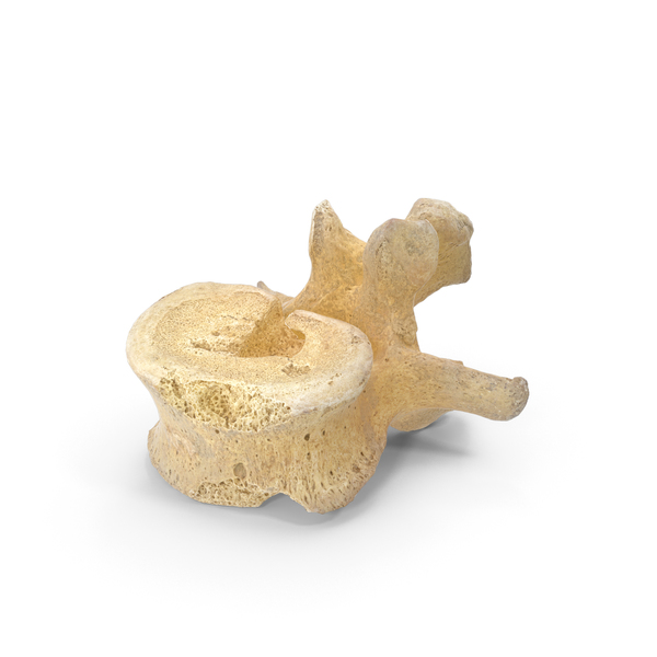 Spine: Damaged Lumbar Vertebrae PNG & PSD Images Spine: Damaged Lumbar Vertebrae PNG & PSD Images