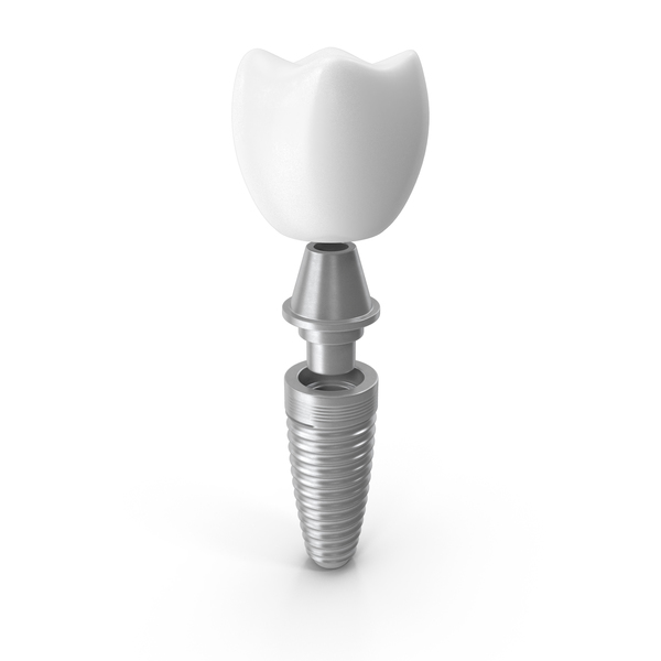 Implant Teeth PNG Images & PSDs for Download | PixelSquid - S11649624C