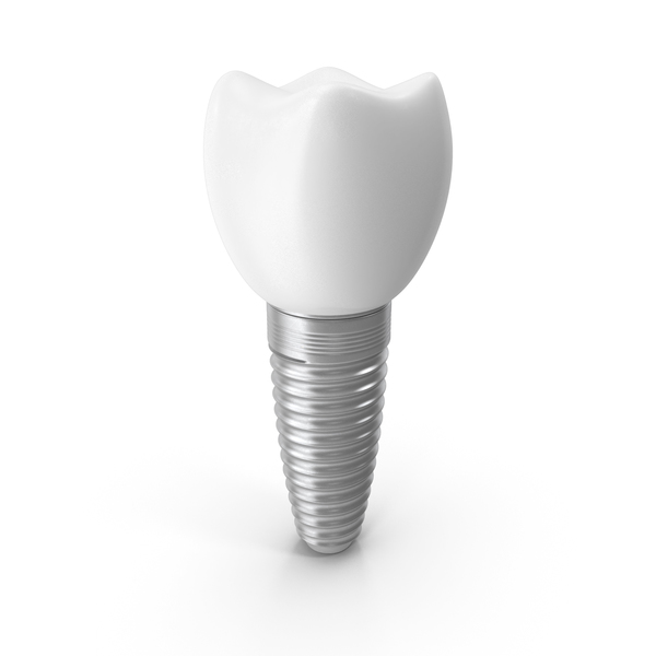 Implant Teeth PNG Images & PSDs for Download | PixelSquid - S116495416