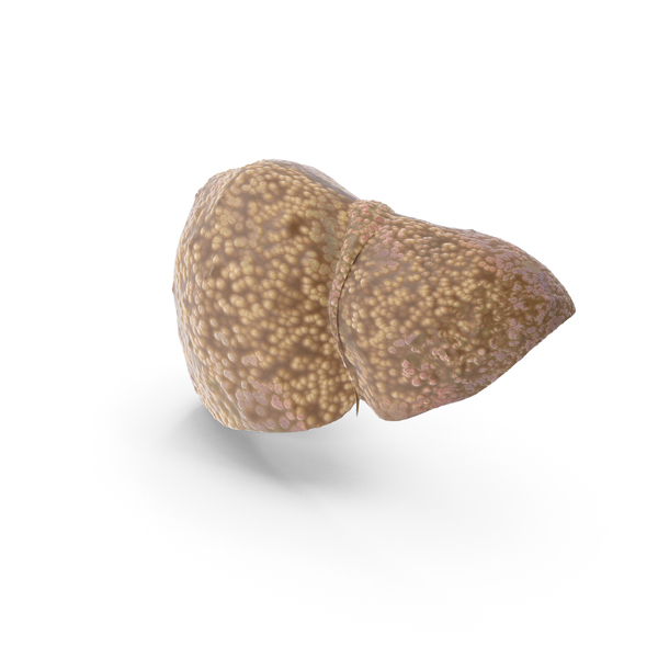 Liver Cirrhosis PNG & PSD Images Liver Cirrhosis PNG & PSD Images