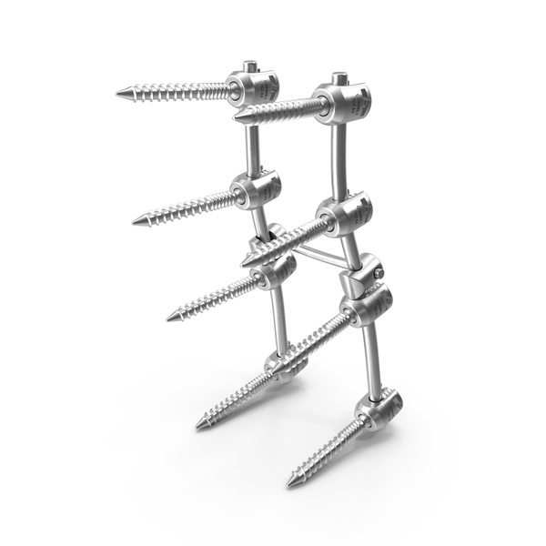 Lumbar Cervical Spine Fixation System PNG & PSD Images