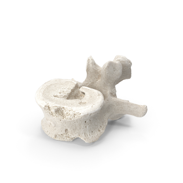 Spine: Lumbar Vertebrae L1 to L5 Damaged White PNG & PSD Images Spine: Lumbar Vertebrae L1 to L5 Damaged White PNG & PSD Images