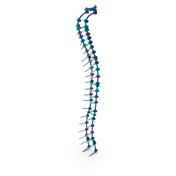Spine Fixation System Colored PNG & PSD Images Spine Fixation System Colored PNG & PSD Images