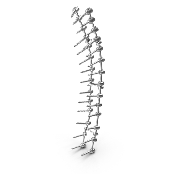Thoracic Spine Fixation System PNG & PSD Images Thoracic Spine Fixation System PNG & PSD Images