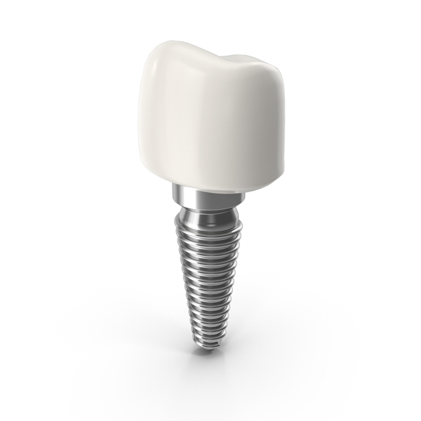 Tooth Implant PNG Images & PSDs for Download | PixelSquid - S12062137E