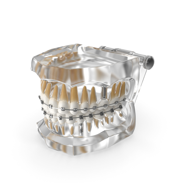 Mold: Transparent Dental Typodont With Bracket and Dental Implants PNG & PSD Images