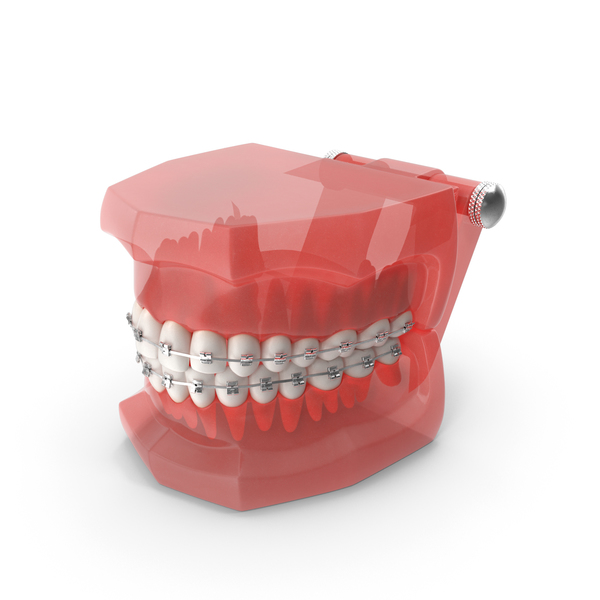 Typodont Teeth Model with Brackets PNG & PSD Images